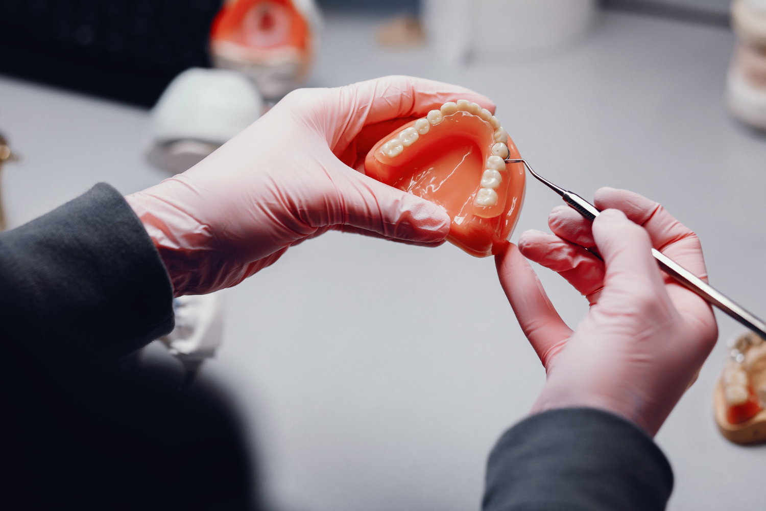 mani di un dentista con un calco di denti in mano